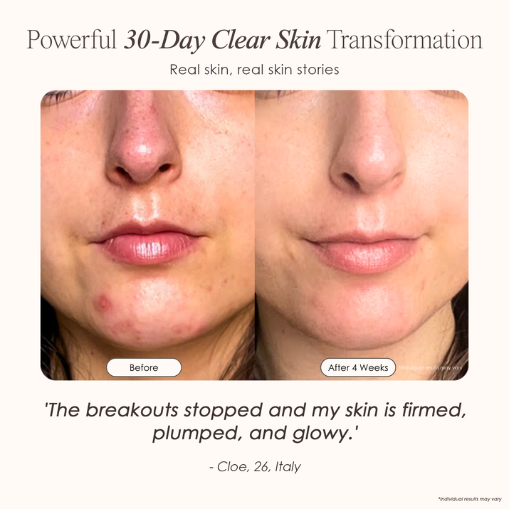 visible results after 30 days of using the High-Frequency Wand
