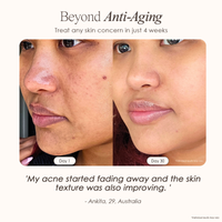 visible results after 30 days of using the High-Frequency Wand