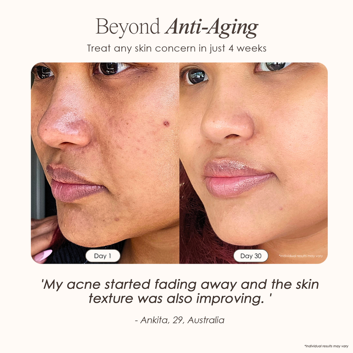 visible results after 30 days of using the High-Frequency Wand