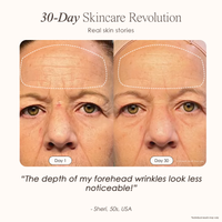 visible results after 30 days of using the LED light therapy mask